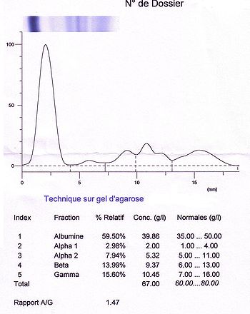 Electrophorese.JPG